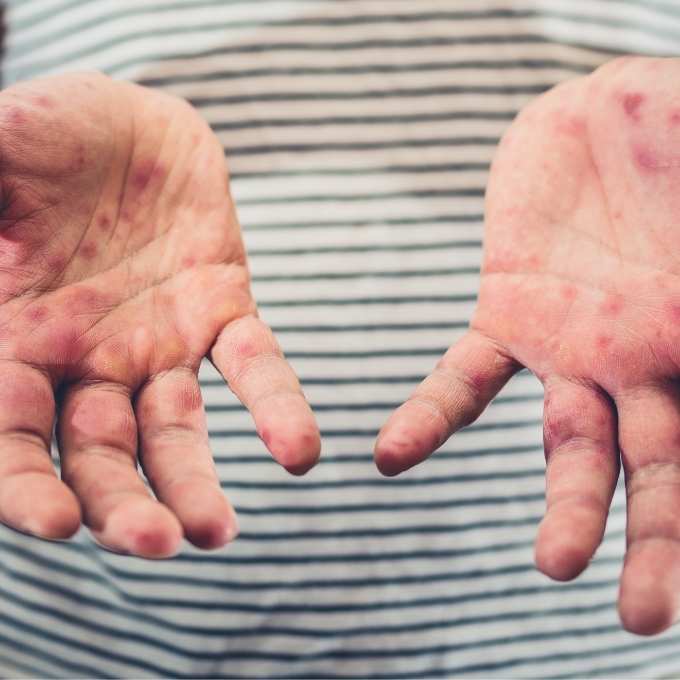 Maine Crime Scene & Trauma Cleanup Services